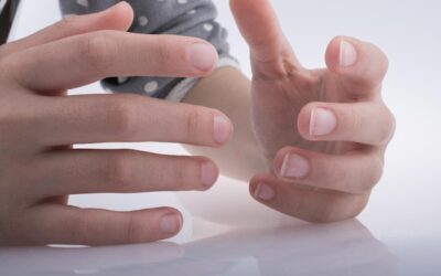 Jak wybielić paznokcie u rąk w domowych warunkach?