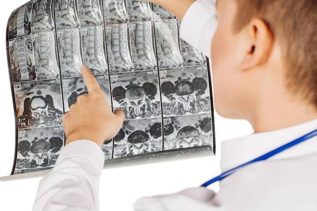 Czy do rezonansu kręgosłupa trzeba się rozbierać?